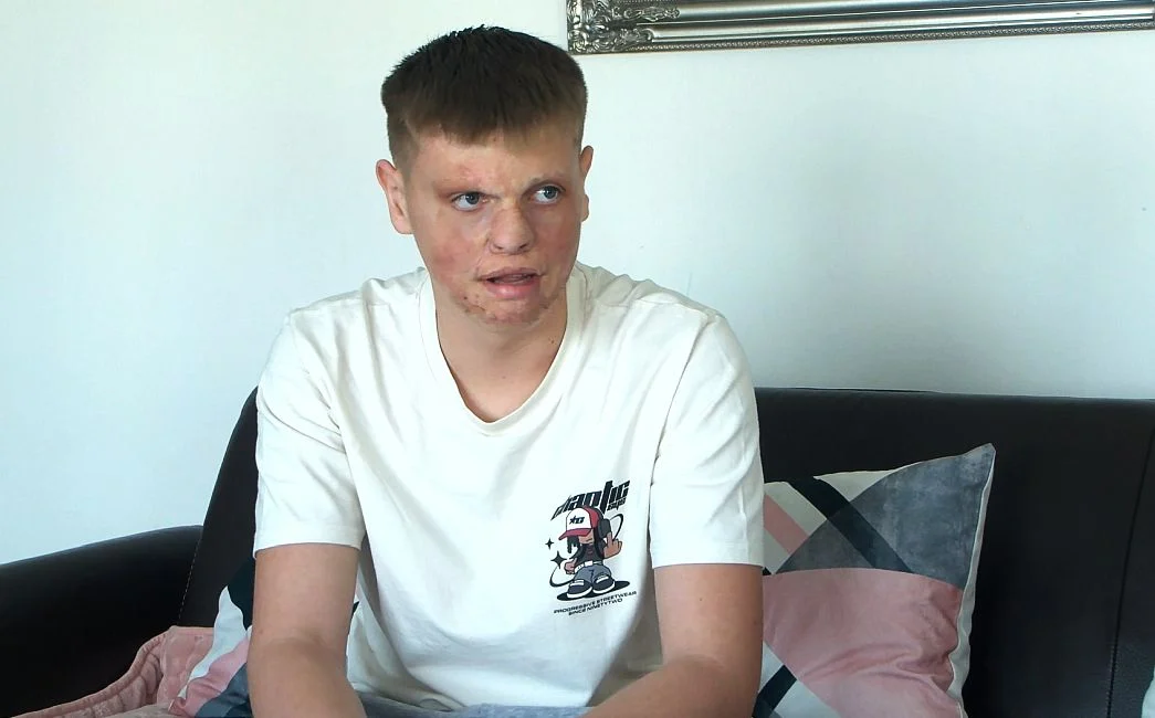 PRIČA O KRISTIJANU – Pomozimo dječaku koji više ne želi skrivati svoje lice